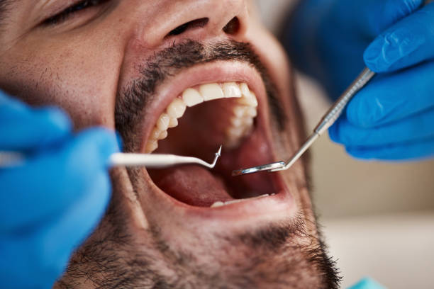 Emergency Gum Pain Relief in DE